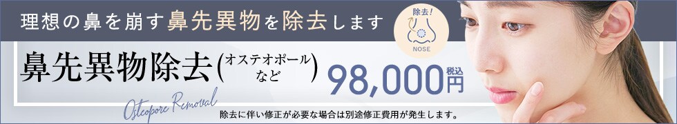 オステオポール除去