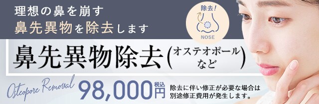 オステオポール除去