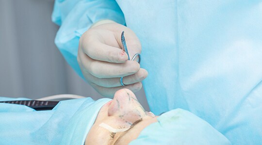 隆鼻術の施術