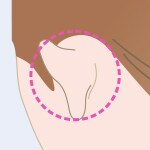 皮膚組織と血液を採取 イメージ画像