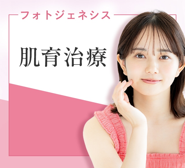 フォトジェネシス