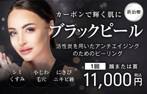 ブラックピール
