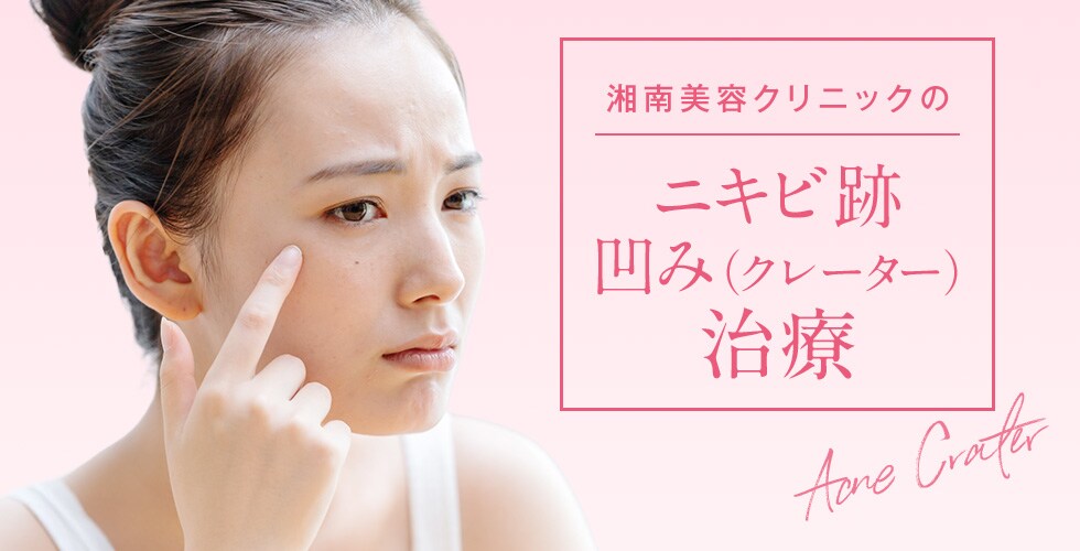 湘南美容クリニックのニキビ跡凹み（クレーター）治療