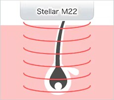 アクネライト イメージ2