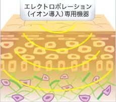 エレクトロポレーション（イオン導入） イメージ2