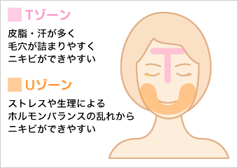 ニキビ ニキビ跡治療 美容皮膚科なら湘南美容クリニック 公式