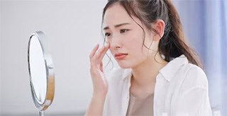 ニキビ跡の色素沈着は消せる？原因からおすすめの治療方法まで徹底解説