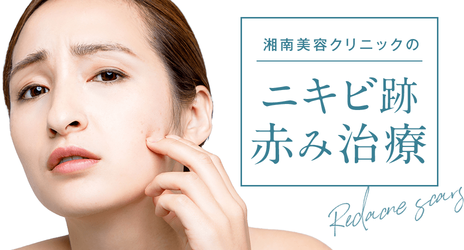 湘南美容クリニックのニキビ跡赤み治療