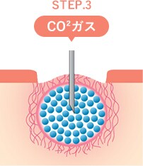 トライフィルプロの仕組み STEP4