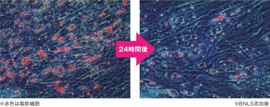 脂肪溶解注射 Bnls Neo 医療ダイエットなら湘南美容クリニック 公式 脂肪溶解注射 Bnls Neo 医療ダイエットなら湘南美容クリニック 公式
