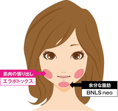 脂肪溶解注射 Bnls Neo 医療ダイエットなら湘南美容クリニック 公式