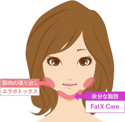 FatX Coreとエラボトックス