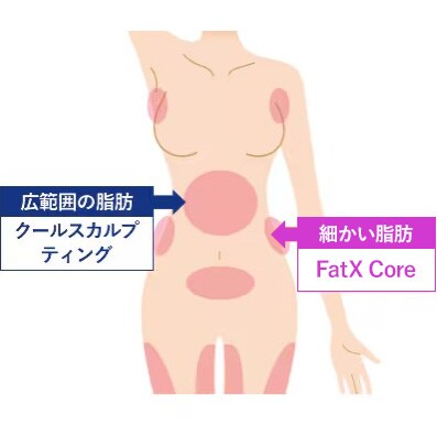 FatX Coreとクールスカルプティング