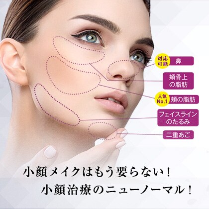 BNLS アルティメット 画像