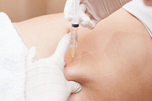 部分痩せを実現し理想のボディデザインができる イメージ