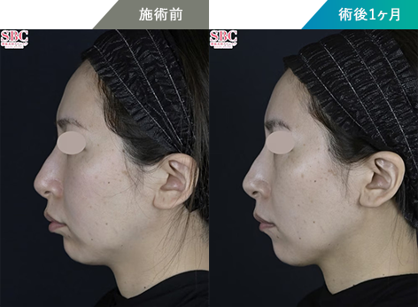 症例写真2