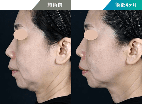 症例写真2
