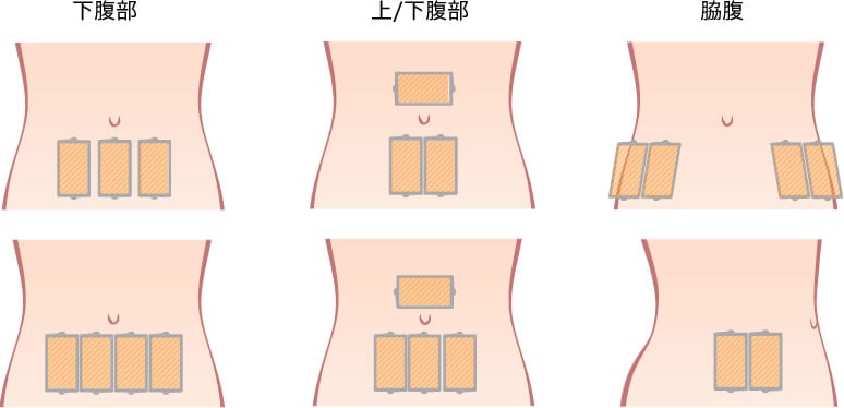 対応部位