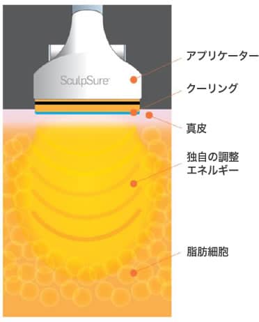 断面図
