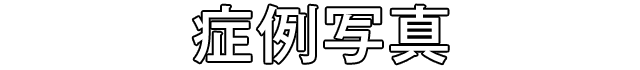 症例写真