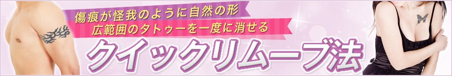 クイックリムーブ法