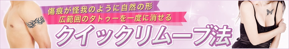クイックリムーブ法