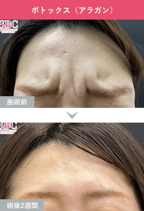 症例写真1
