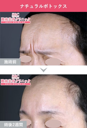 症例写真1