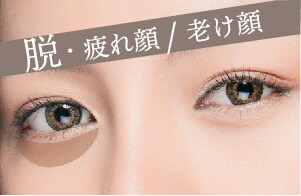 目の下の切らないクマ・たるみ取り