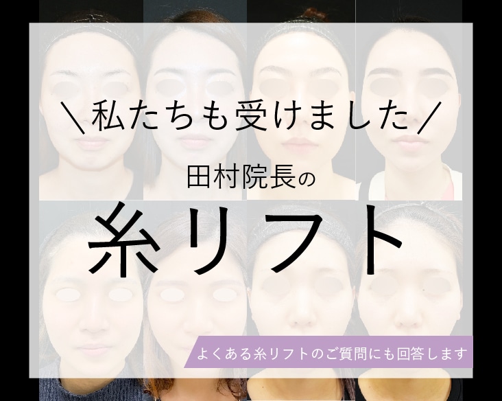 大阪あべの院 田村院長の糸リフト＼実際に受けたスタッフ症例をご紹介／よくあるご質問にもお答えします♡