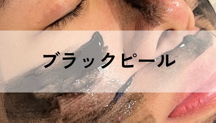 活性炭×乳酸でしっかりピーリング&アンチエイジング<br />
「ブラックピール」