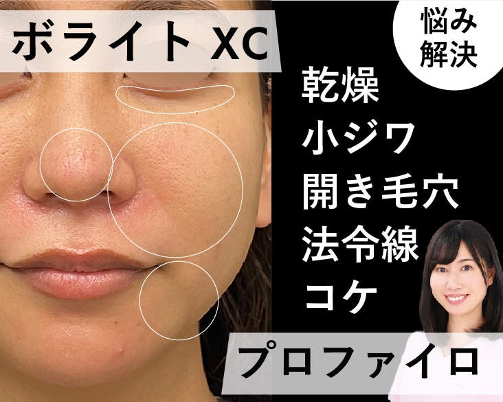 大阪あべの院スタッフが受けた【プロファイロ＆ボライトXC】実際どんな感じか調査した件