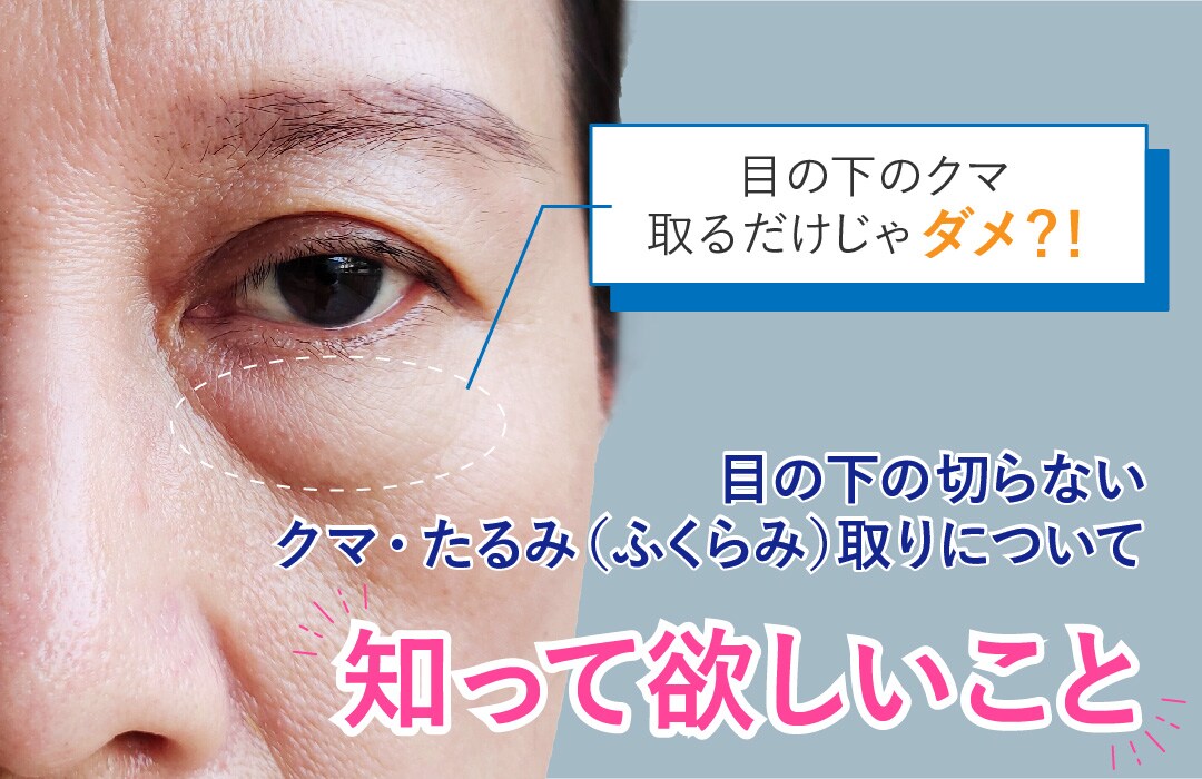 ふくらみかけ　二次 大阪あべの・天王寺エリアで目の下の切らないクマ・たるみ（ふくらみ）取り！目袋３脂肪を撃退して若返り！ - 大阪あべの院