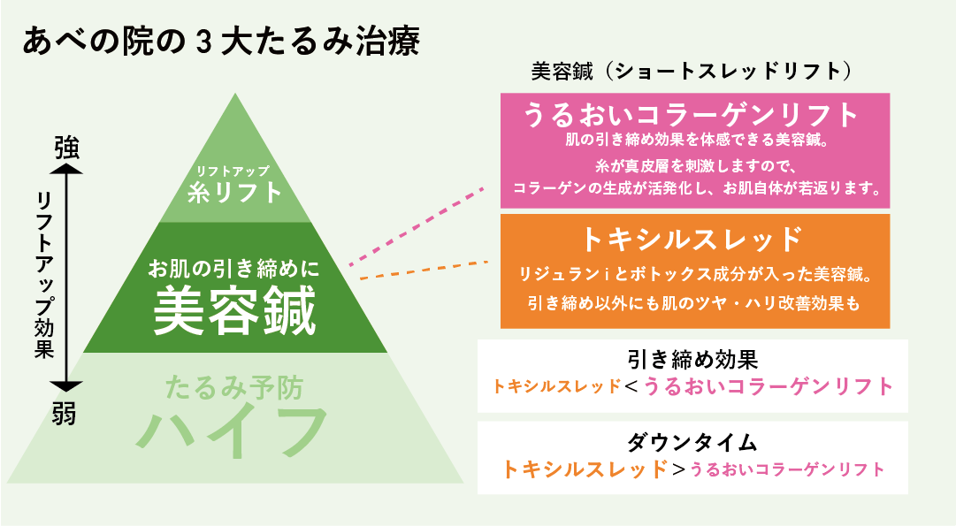ハイフよりも引き締めたいなら美容鍼<br />
