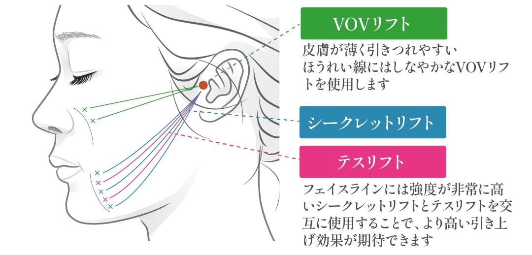 一本一本適した箇所に”最良の糸”