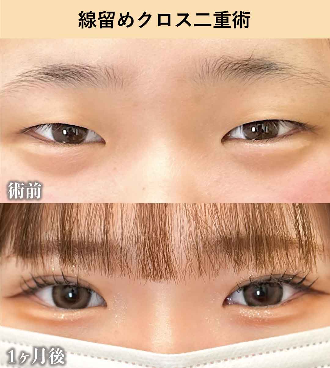 失敗のリスクが少ない<br />