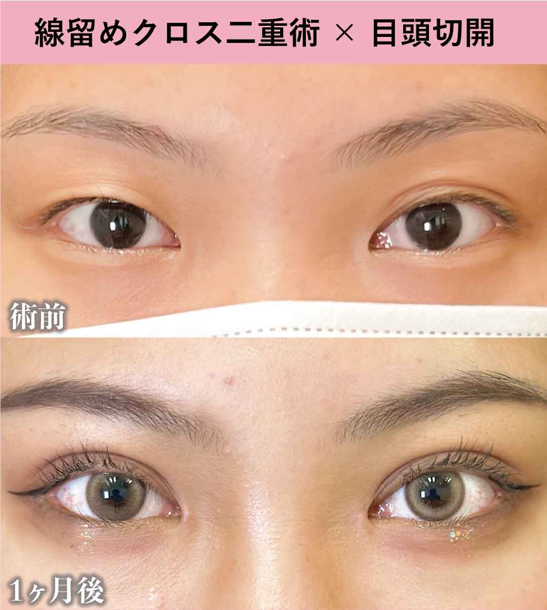 症例写真をSNSやHPで確認
