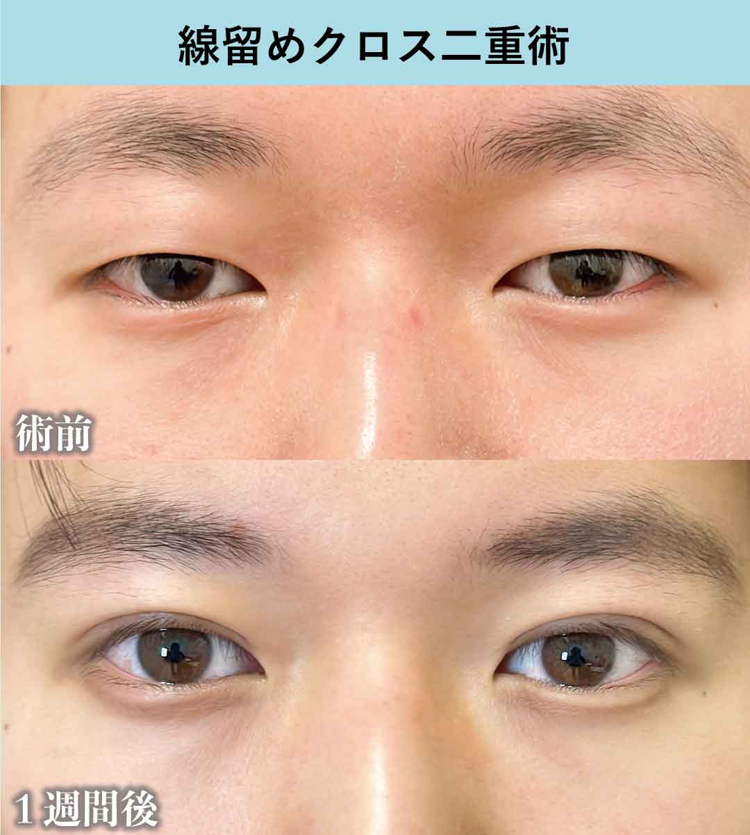 症例写真の美しさ<br />