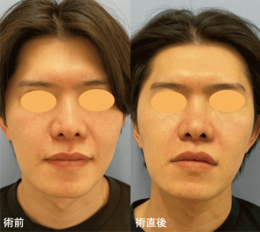 デンシティのダウンタイムは？