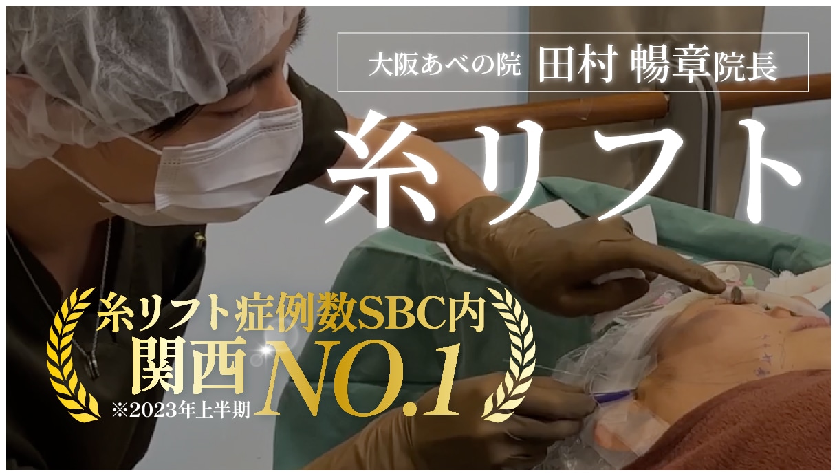 ナチュラルなのに確実に引き上げ＜バレずに完了＞させる田村院長の糸リフト