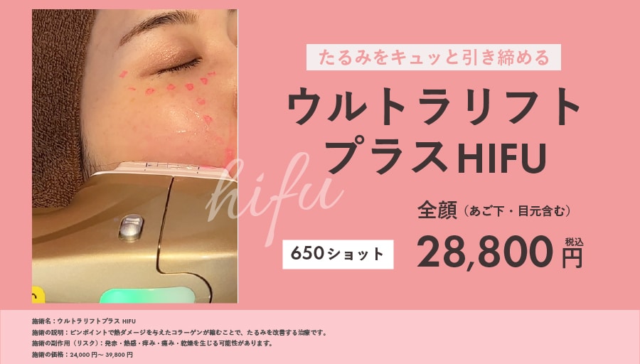 ウルトラリフトプラスHIFU