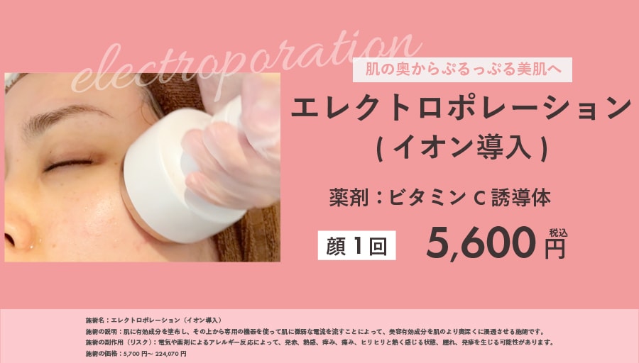 エレクトロポレーション(イオン導入)