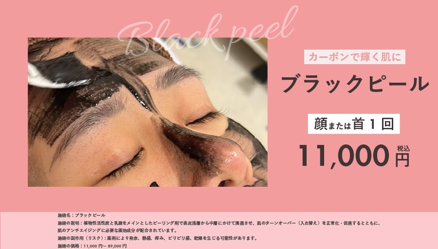 ブラックピール