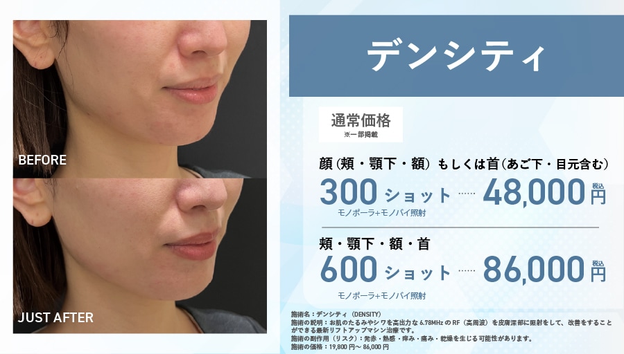 【デンシティ】高密度な「肌の引き締め」