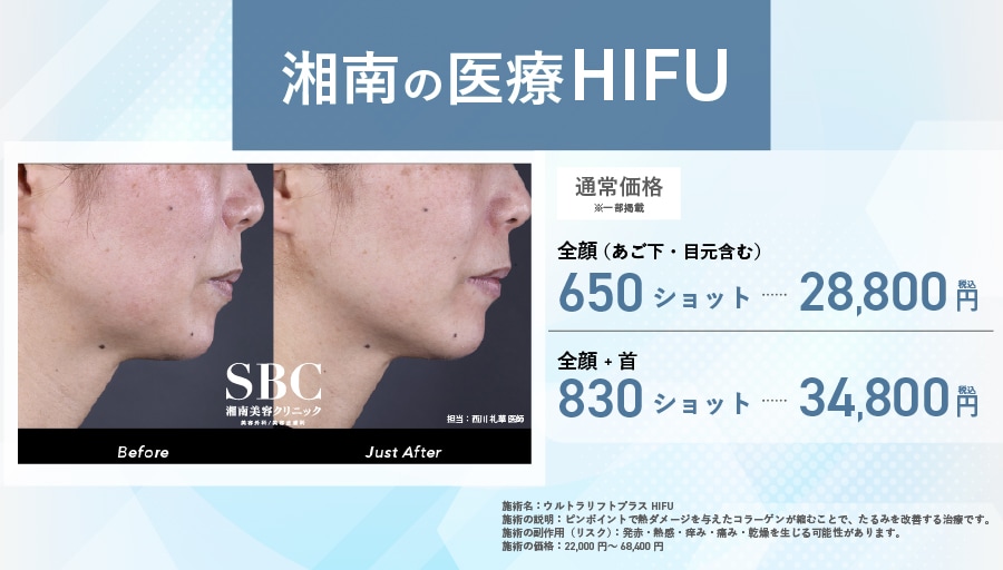 【湘南の医療HIFU（ウルトラセルQ+）】切らない「土台のリフォーム」