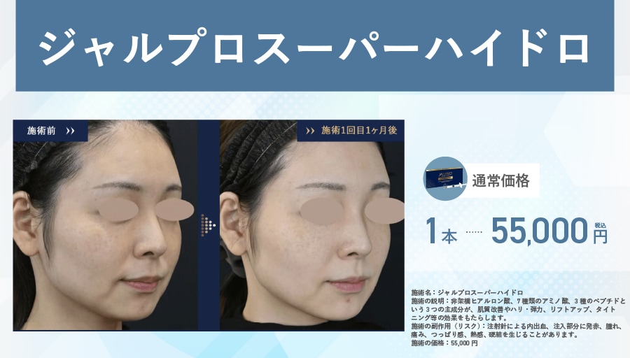 【ジャルプロ スーパーハイドロ】肌育で「若々しい弾力」を再構築