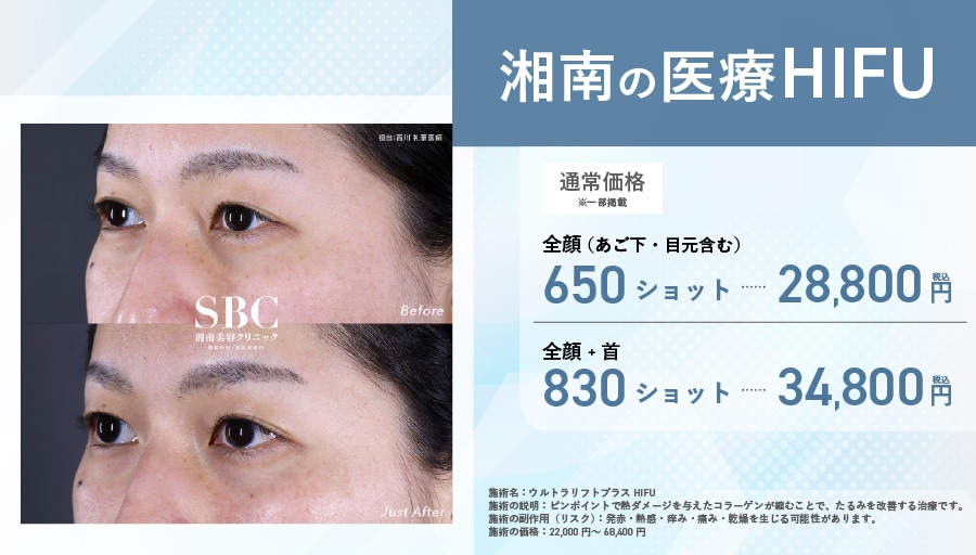 【湘南の医療HIFU（ウルトラセルQ+）】切らない「土台のリフォーム」