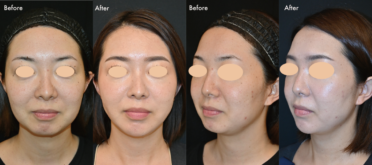 まずはスタッフたちのリアルな症例写真をご紹介