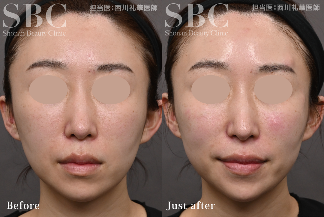 スキンプログラム症例