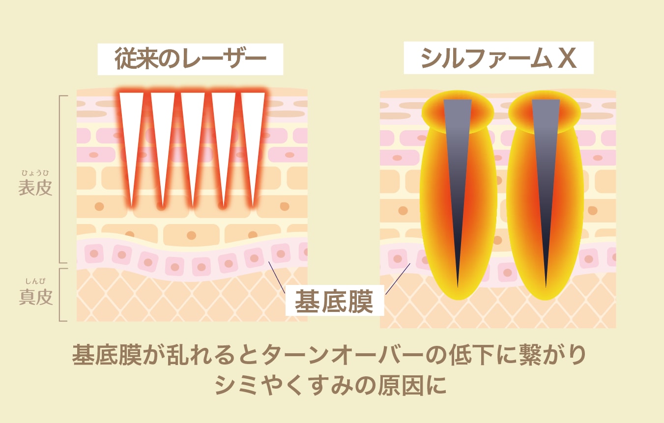 ダウンタイムを最小限に抑えた最新RF治療